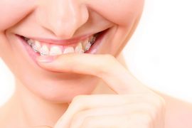 出っ歯について