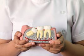 虫歯や炎症のリスクを減らす！親知らずの正しい磨き方