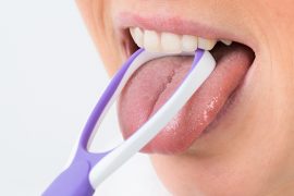 舌癌予防には虫歯予防も重要！舌と歯の関係性とは