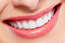 歯の矯正をすれば「受け口」も改善できる？