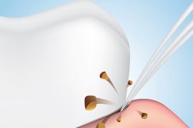 歯並びが悪い人におすすめ！「ワンタフトブラシ」とってどんなもの？