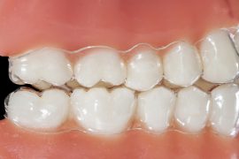 【体調不良は“サイン”かも】 歯ぎしりに気づくポイント